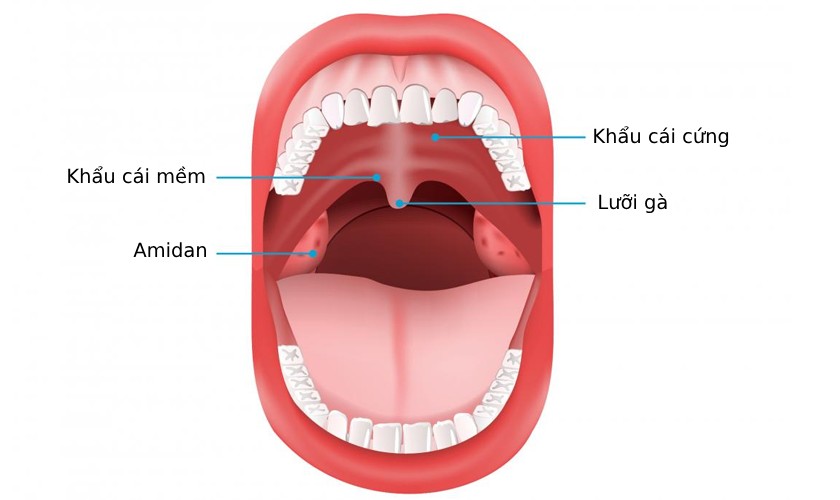Khẩu cái có dạng vòm cung