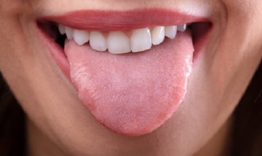Lưỡi thường có màu hồng nhạt