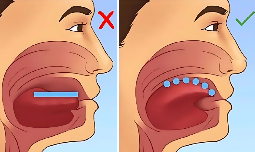 Một số lỗi sai khi tập Mewing