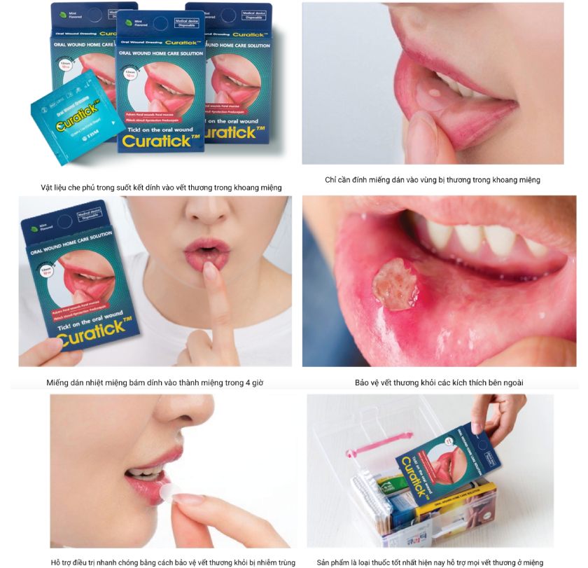 Sử dụng miếng dán nhiệt miệng đúng cách sẽ mang lại hiệu quả như mong đợi