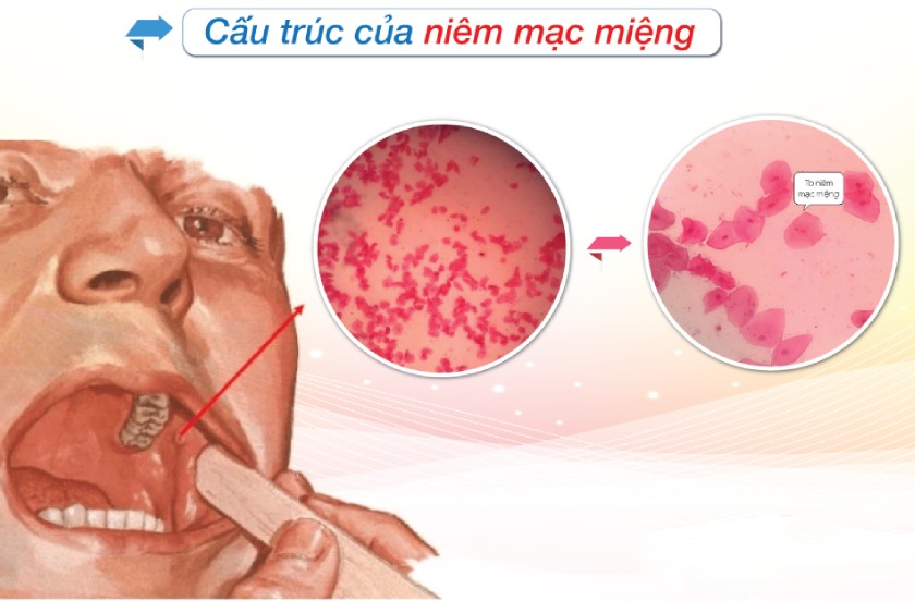 Cấu trúc của niêm mạc miệng