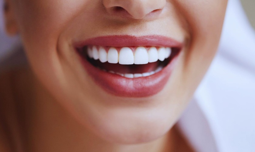 Bọc răng sứ thẩm mỹ giúp khắc phục răng chó nhanh chóng