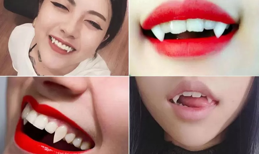 Răng nanh đẹp hay xấu? Làm răng nanh như thế nào?