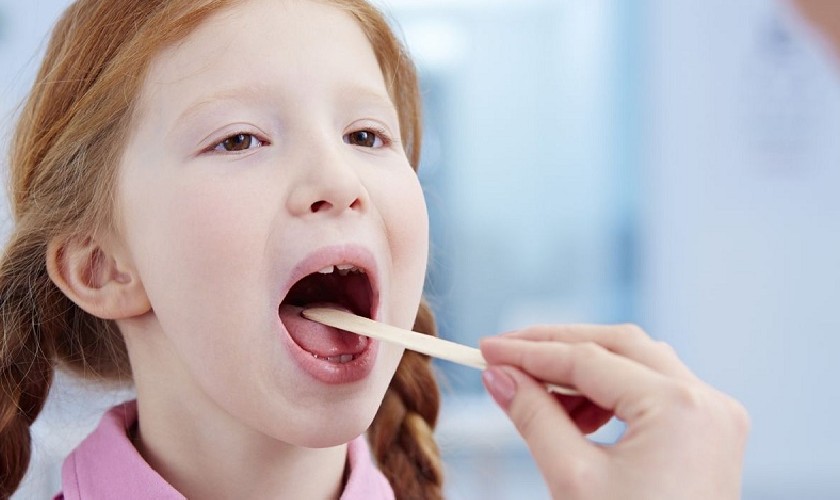 Lấy dịch cổ họng cũng là cách để chẩn đoán bệnh tưa miệng