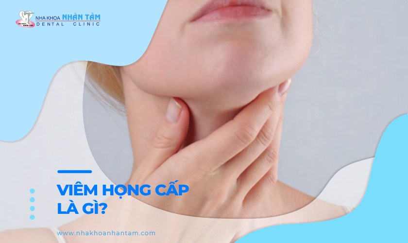 Viêm họng cấp là gì? Nguyên nhân và cách điều trị thế nào?