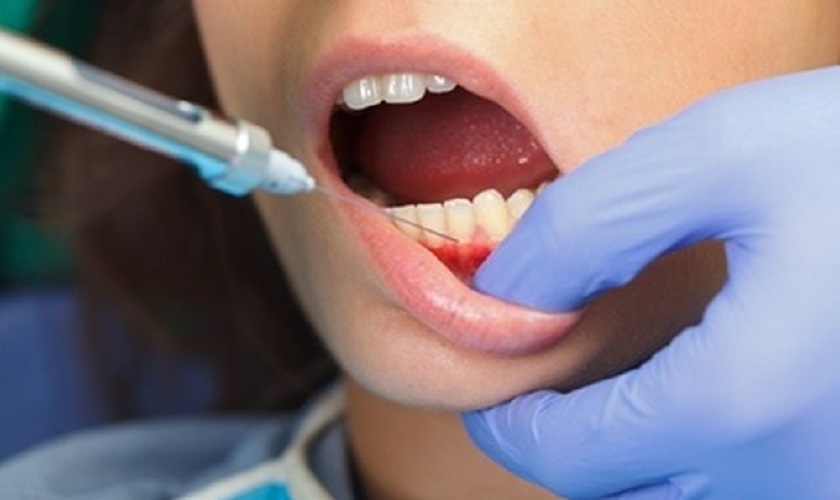 Trước khi thực hiện mài răng bọc sứ khách hàng sẽ được gây tê để không cảm thấy đau nhức