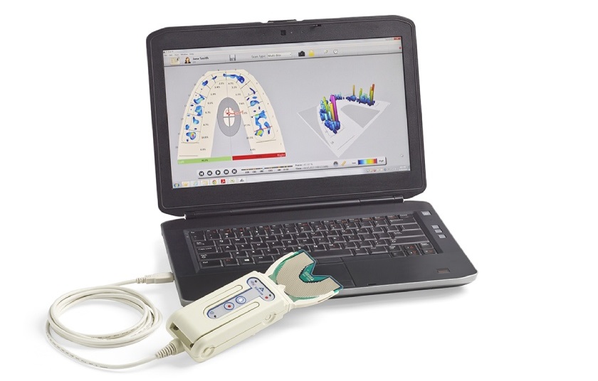 Hệ thống phân tích và thẩm định khớp cắn T-scan