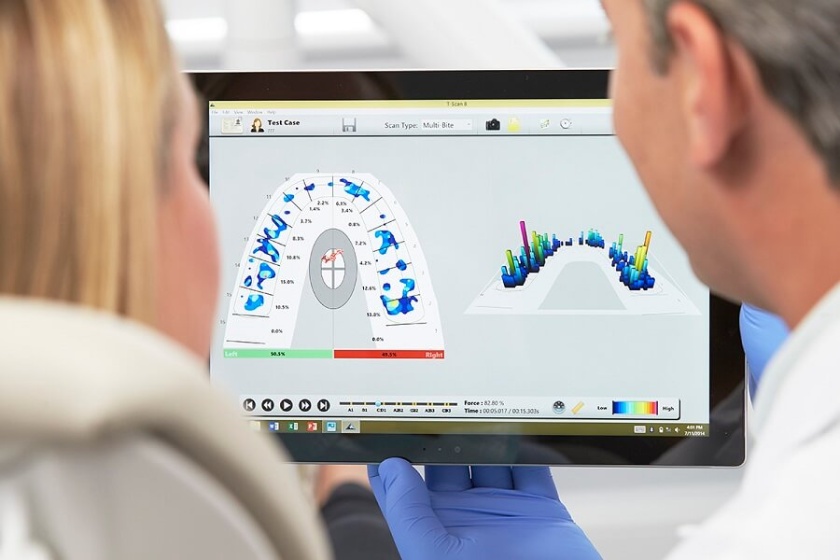 Kiểm tra và đánh giá khớp cắn nhanh chóng, chính xác, hiệu quả với T-Scan