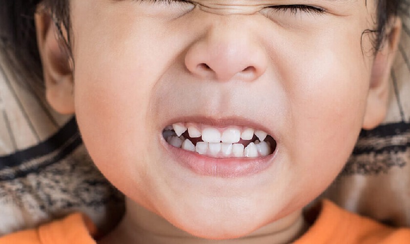 Trẻ nghiến răng tạo ra âm thanh ken két rất khó chịu Trẻ nghiến răng tạo ra âm thanh ken két rất khó chịu