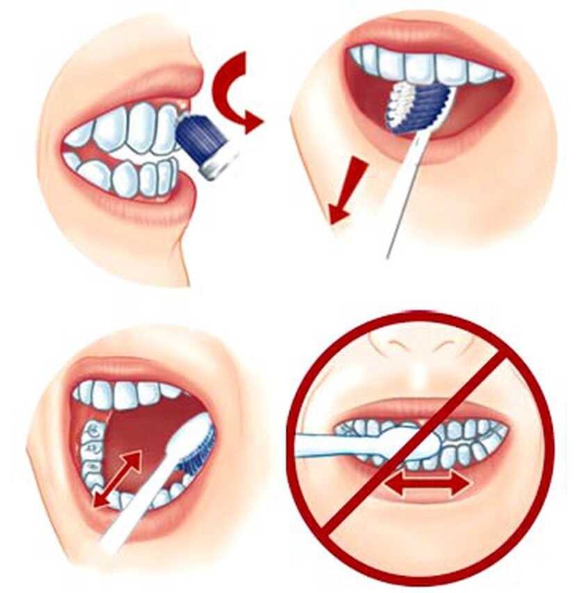 Bạn cần chăm sóc răng miệng kỹ càng để tránh vi khuẩn phát triển