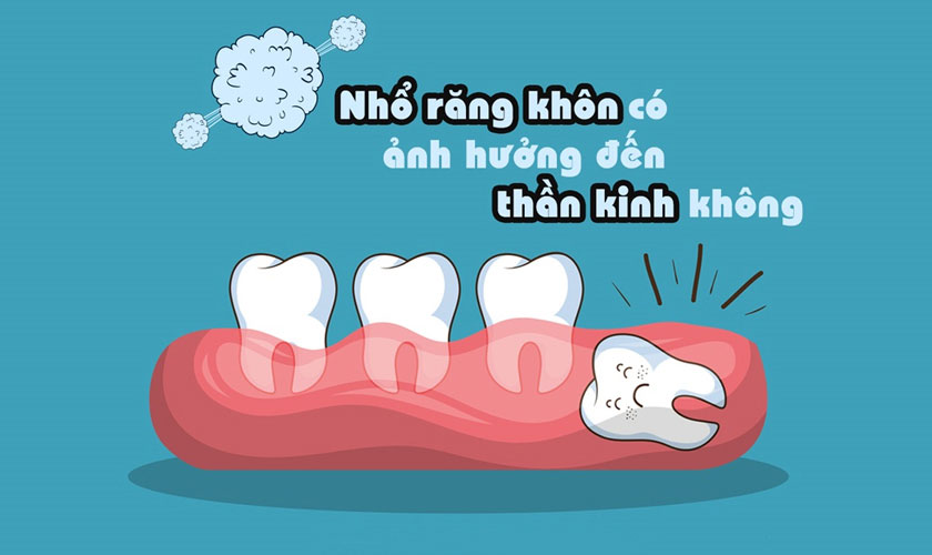 Giải mã: Nhổ răng khôn có ảnh hưởng đến dây thần kinh không?
