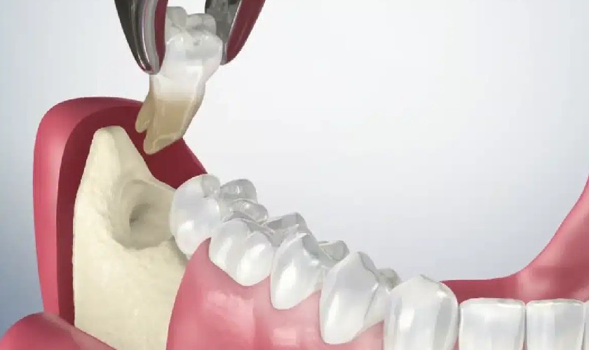 Thời gian lành thương sẽ tùy vào cơ địa của mỗi người