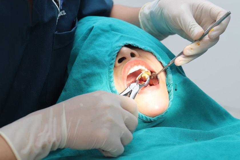 Cần xem xét trình độ, tay nghề của các y bác sỹ trước khi lựa chọn địa chỉ nhổ răng khôn