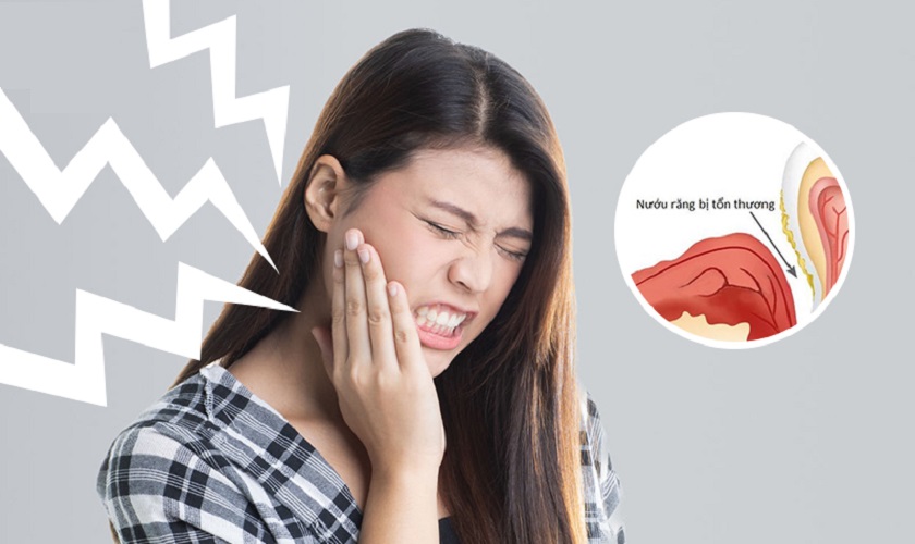 Nên xử trí thế nào nếu bị sưng nướu răng khôn?