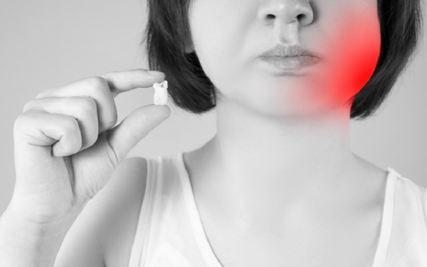 Nhổ răng khôn có ảnh hưởng đến thần kinh không?