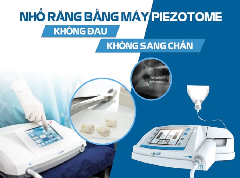Máy nhổ răng khôn siêu âm Piezotome