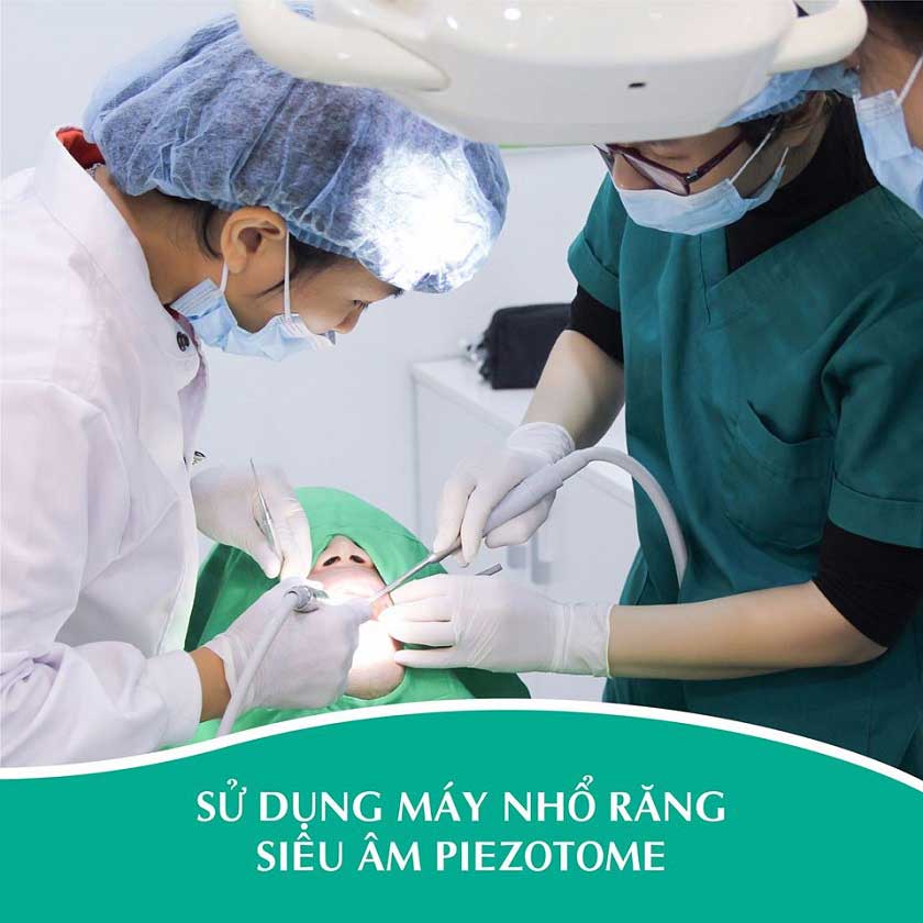 Nhổ răng khôn bằng máy siêu âm Piezotome