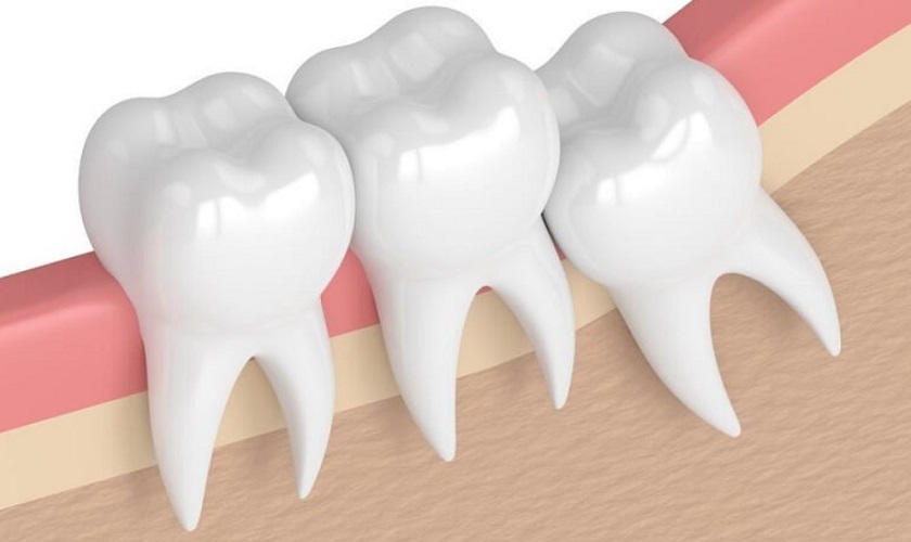 Răng khôn mọc khi nào? Dấu hiệu khi mọc răng khôn