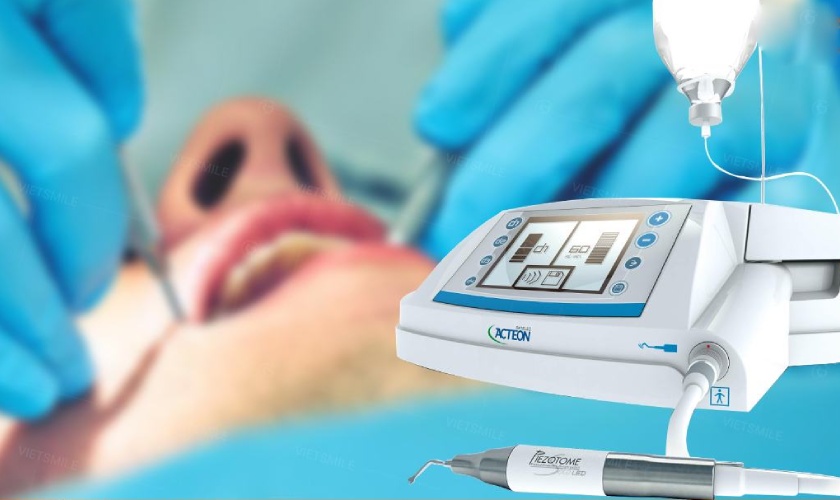 Nha khoa Nhân Tâm ứng dụng công nghệ nhổ răng Piezotome