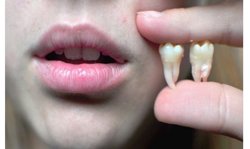 Những biến chứng có thể xuất hiện