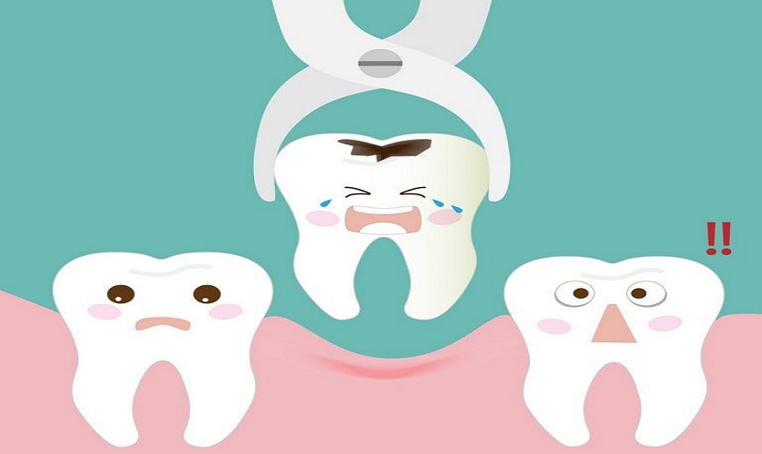 Cân nhắc kỹ lưỡng trước khi nhổ răng giá rẻ