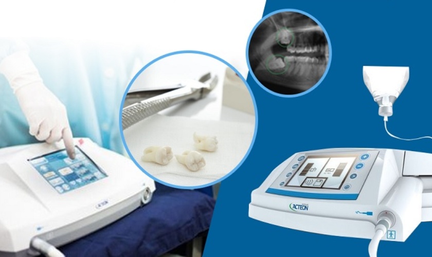 Công nghệ Piezotome giúp nhổ răng khôn không đau
