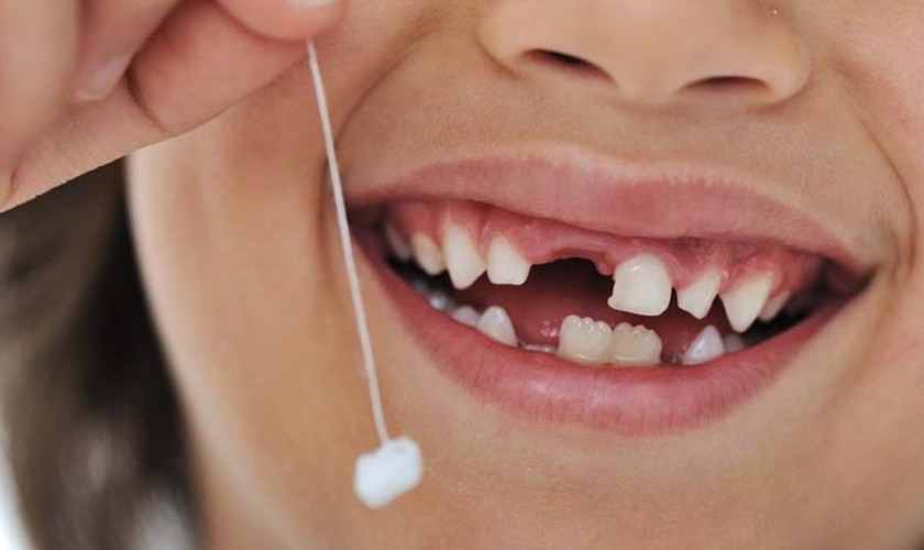 Nhổ răng trẻ em cần phải thực hiện đúng cách
