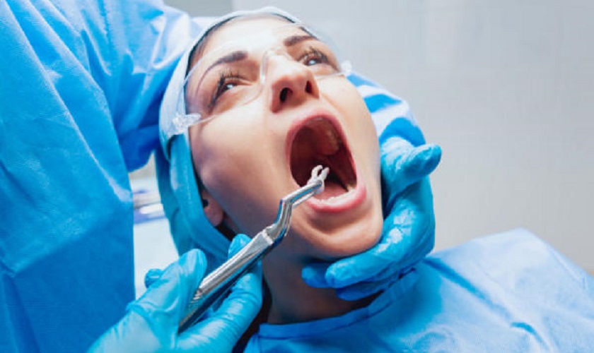Những vấn đề cần chú ý để đảm bảo an toàn khi nhổ răng