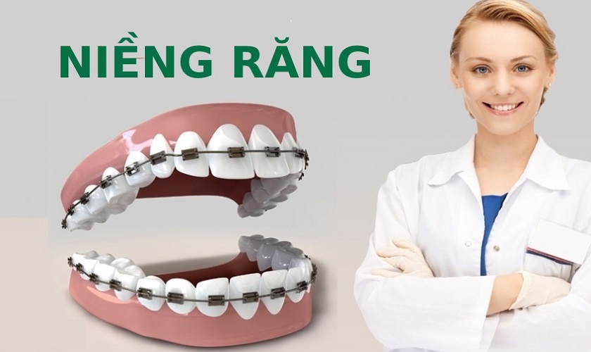 4. Phân Tích Chuyên Sâu Các Phương Pháp Niềng Răng