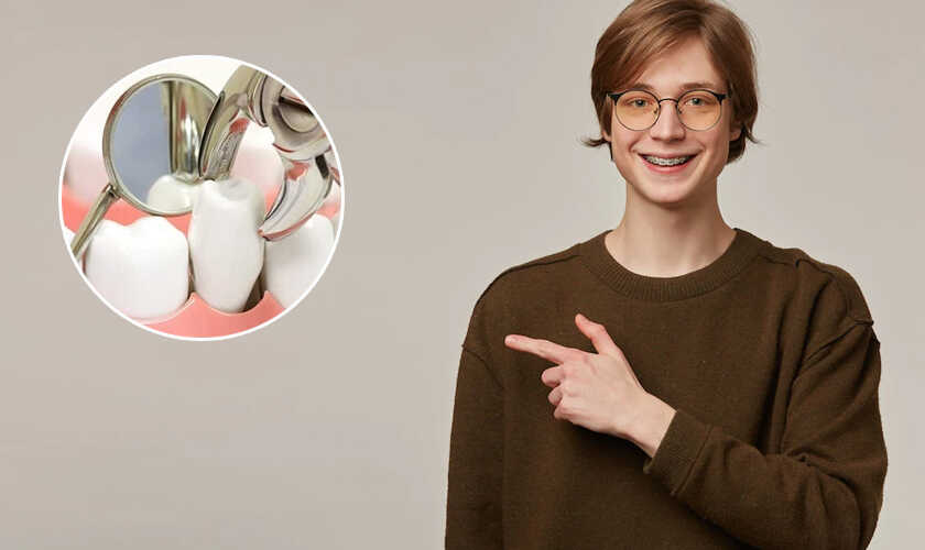 Niềng răng ở đâu tốt? Vì sao phải nhổ răng số 4 khi niềng?