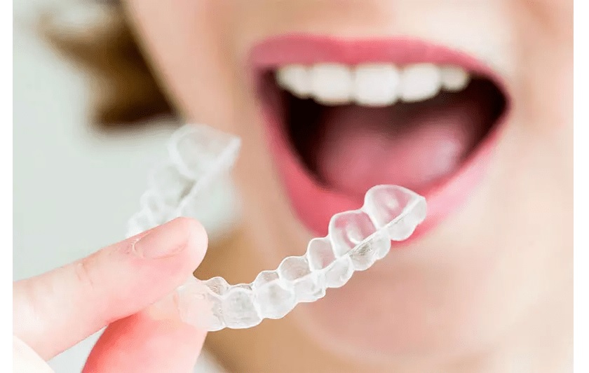 Chất liệu của khay niềng trong suốt đảm bảo an toàn tuyệt đối với trẻ nhỏ