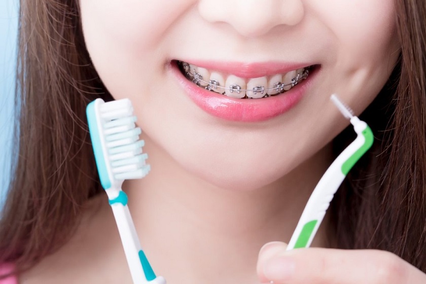 Chăm sóc răng miệng đúng cách là thói quen tốt bạn cần duy trì