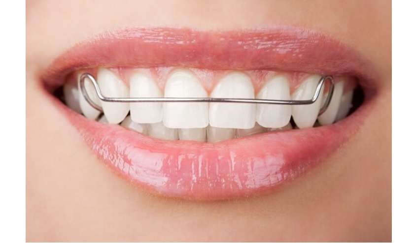 Hàm duy trì cố định