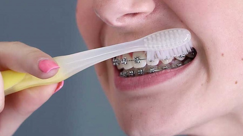 Cần lựa chọn thức ăn hợp lý để bảo vệ sức khoẻ răng miệng