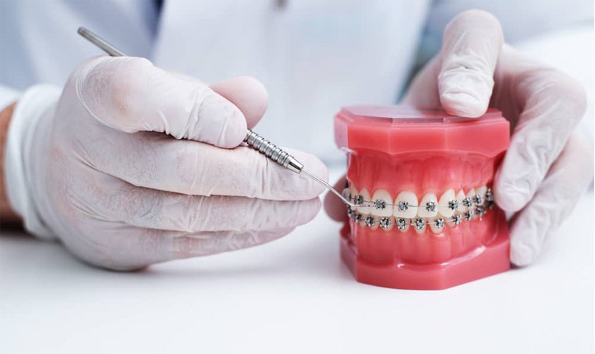 NIỀNG RĂNG TÀNG HÌNH INVISALIGN  NIỀNG KHÔNG AI HAY THÁO KHÔNG AI BIẾT   Nha Khoa Kan Dental  Thẩm mỹ nụ cười công nghệ Mỹ