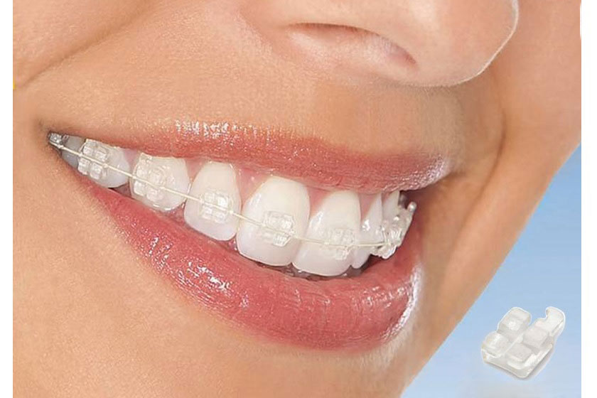 Dây cùng bằng niken trong suốt