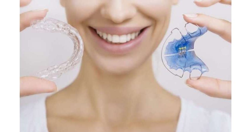 Bạn đã biết cách vệ sinh hàm duy trì sau niềng đúng nhất chưa?