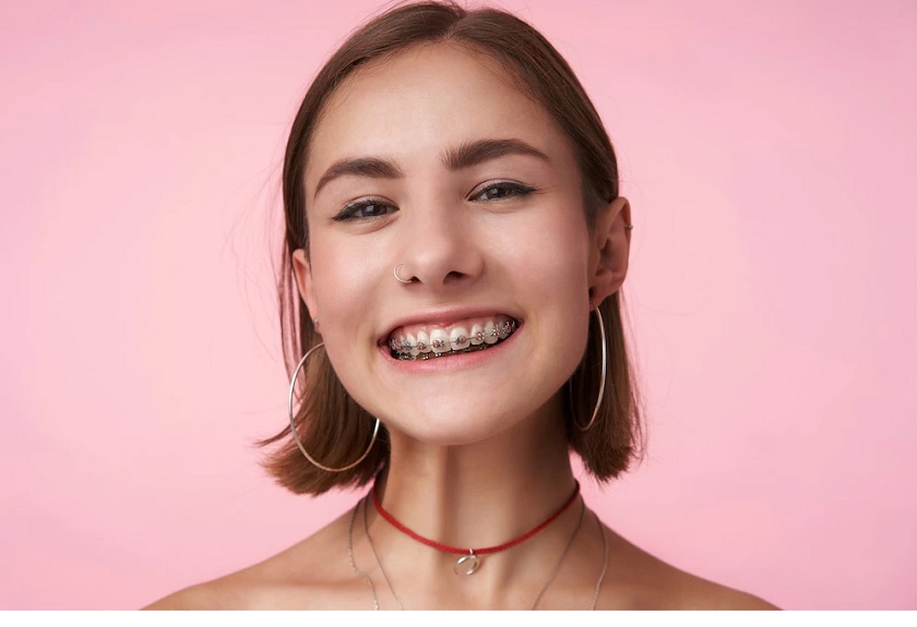 Răng bị chết tuỷ có thể niềng răng chỉnh nha không?