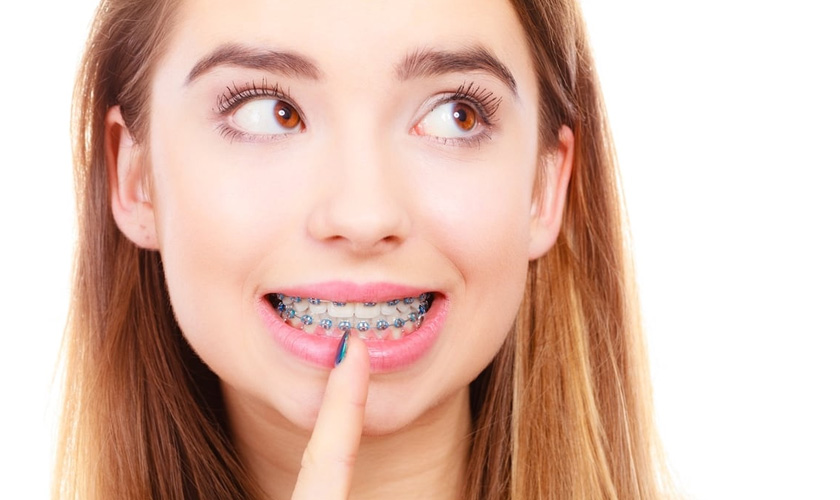 Niềng răng có làm yếu răng hay không?