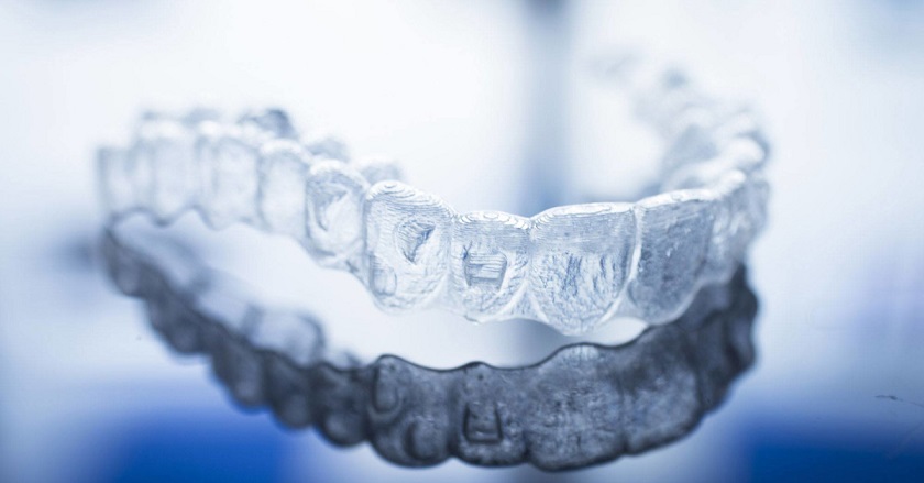 Phương pháp niềng răng trong suốt Invisalign