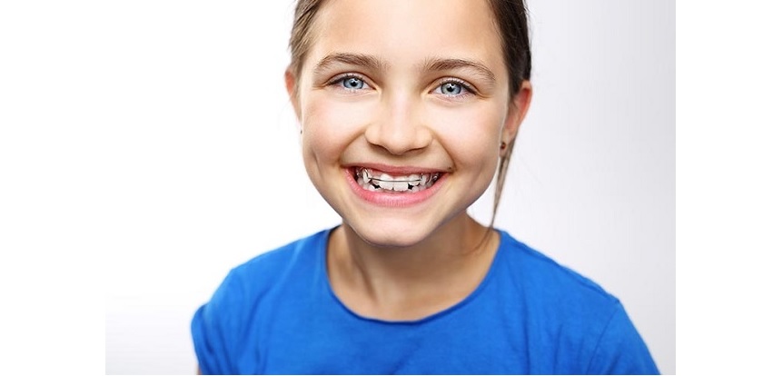 12-16 tuổi là giai đoạn “vàng” để niềng răng
