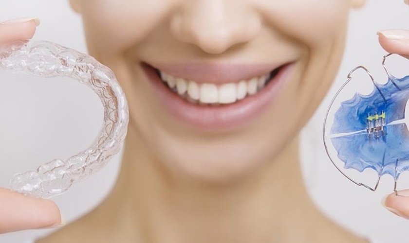 Các loại hàm duy trì sau niềng răng