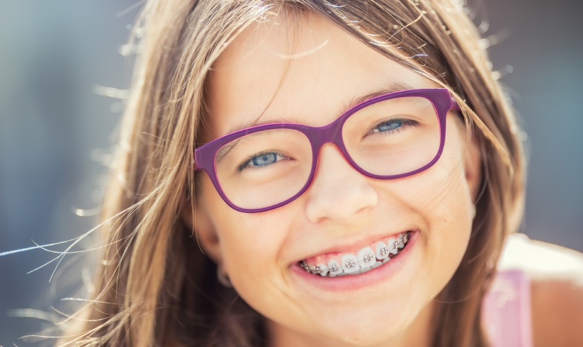 Trẻ em từ 12 – 16 tuổi là độ tuổi niềng răng tốt nhất