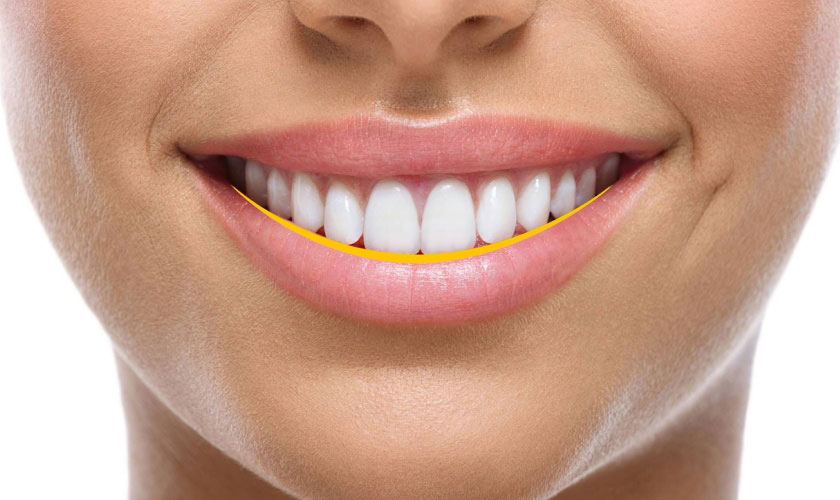 Tiêu chuẩn của một nụ cười đẹp