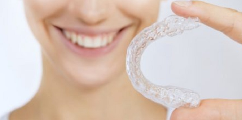 Đeo khay niềng ít nhất 22 giờ mỗi ngày để đảm bảo hiệu quả chỉnh nha