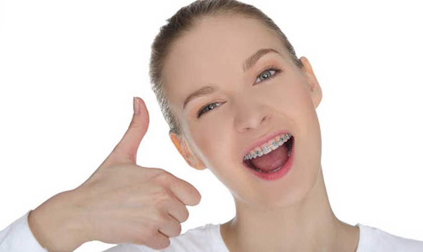 Một quá trình niềng răng đạt chuẩn được tiến hành thế nào?