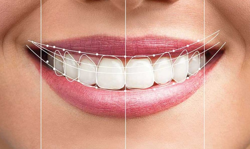 Có rất nhiều phương pháp khắc phục tình trạng hở lợi