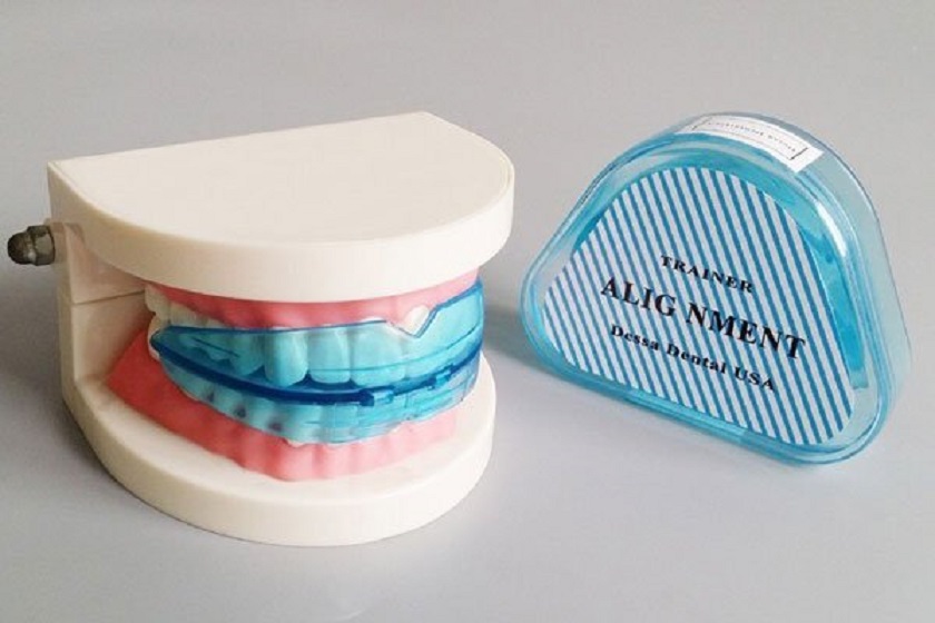 Những hạn chế của niềng răng trainer