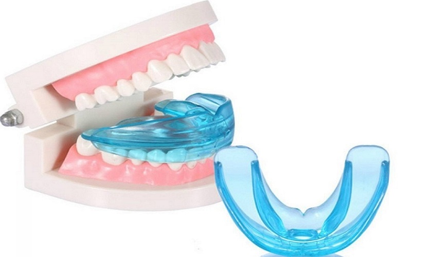 Những điều cần biết về niềng răng trainer