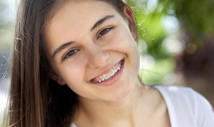 Niềng răng đem đến hàm răng đều, đẹp, chắc khỏe